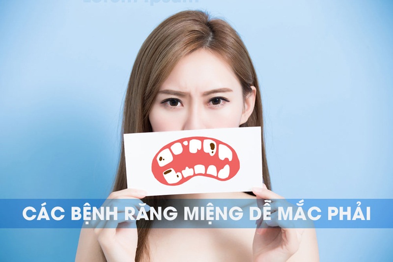 He lo nhung dieu it ai biet ve chay mau chan rang