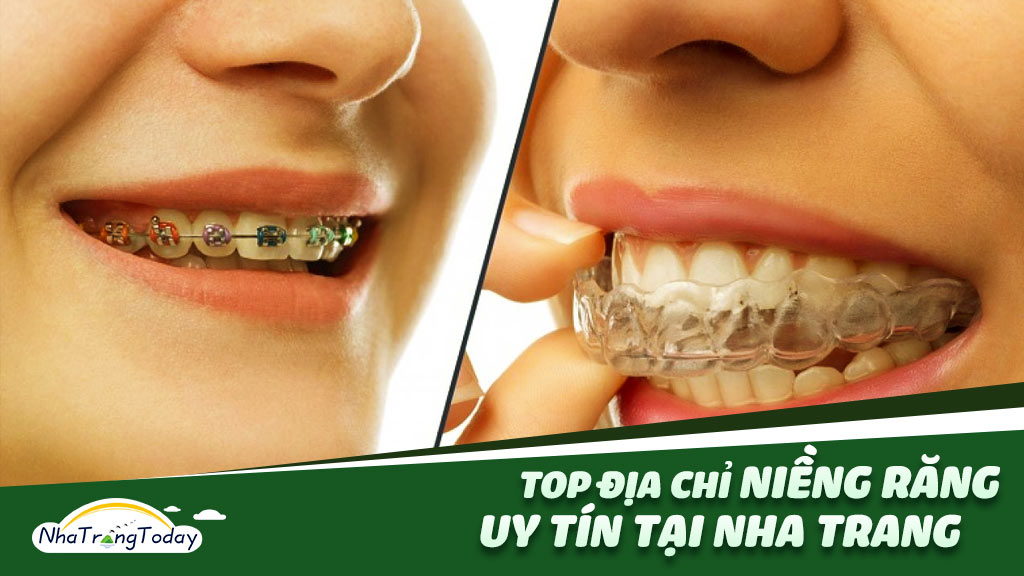 Bệnh răng miệng